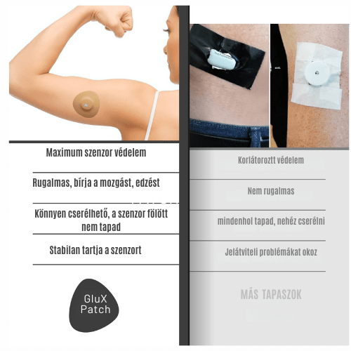 CGM fedőtapasz CGM patch (extra védelem+tapadás) 2 db fekete - GluX