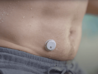 LinX folyamatos cukormérő szenzor glükózmonitor (CGM) szenzor (havi feliratkozással) + ajándék - GluX